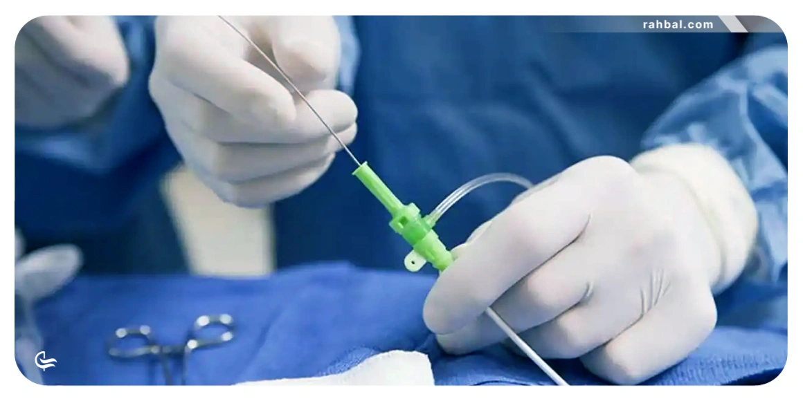 بیمارانی که آنژیوپلاستی انجام دادهاند