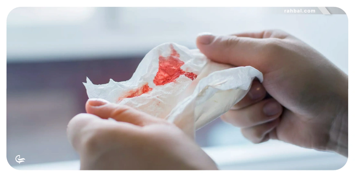 مبتلایان بیماری های خونی | افراد با مشکلات خاص