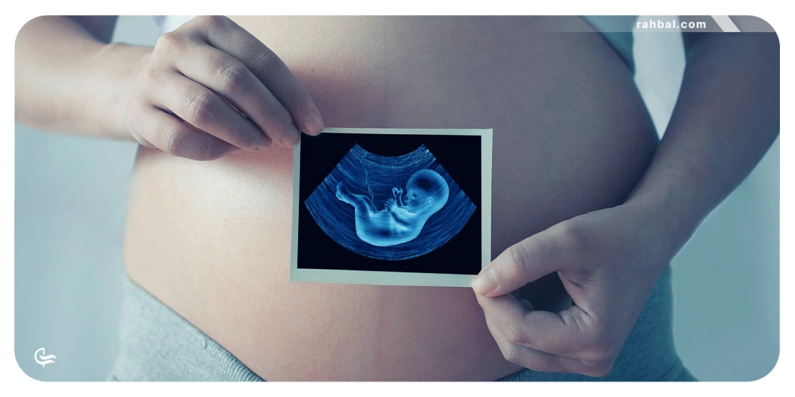 زنان باردار | صدر لیست افرادی که نباید سوار هواپیما شوند